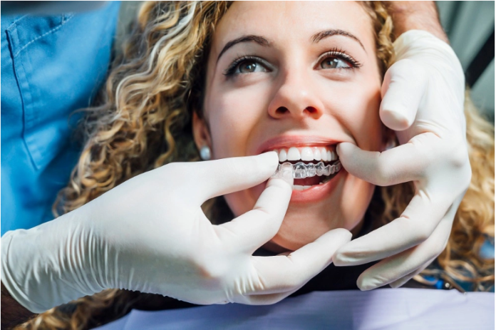 Invisalign Lite